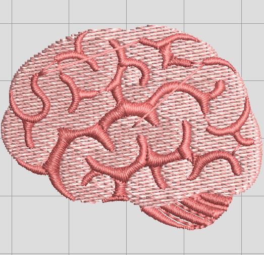 Fichier:Brain-noto-simulation-2.jpg
