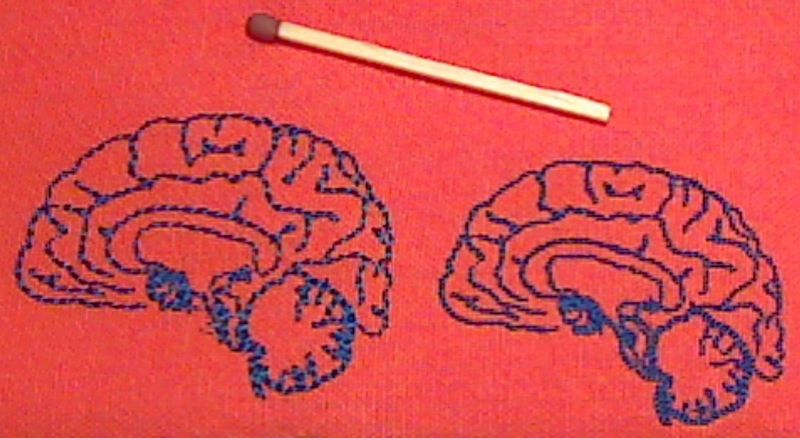 File:Brain-embroidered-2.jpg