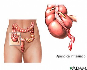 Human appendix.jpg