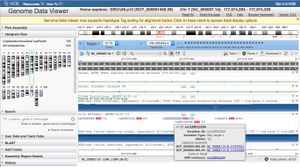 Séquence du gène CFTR avec le SNP rs1228922204 sélectionné, mettant en évidence le changement d'une base