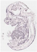 Coupe d'embryon sur Eurexpress montrant le degré d'expression de l'hémoglobine B